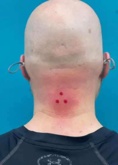 Red Bold Three Dots Tattoo Behind the Neck